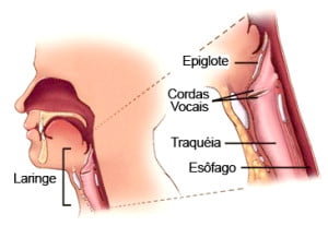 Larynx Tumors