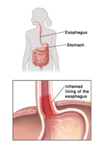 Esophagus