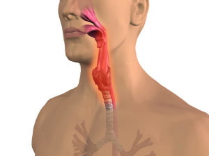 Throat Inflammation2